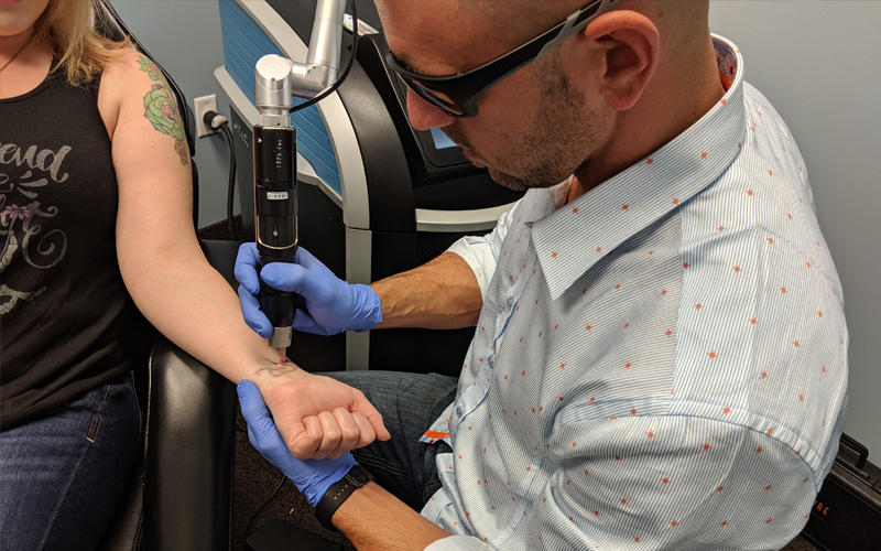 PicoSure Tattoo Removal in Altoona, Pennsylvania