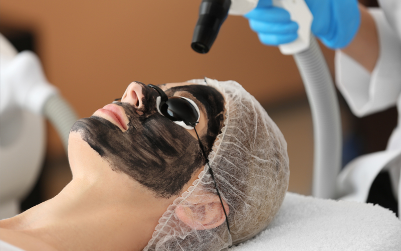 Carbon laser peel procedure for skin rejuvenation
